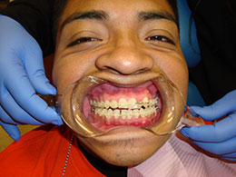 Best Dentist in Newark
