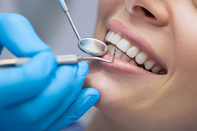 Dental Checkups in Newark