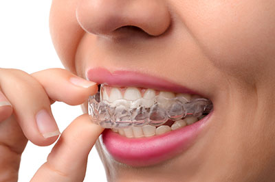 Newark invisalign